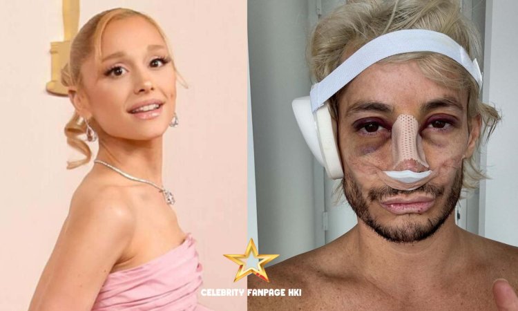 Ariana Grande reage ao nariz do irmão Frankie