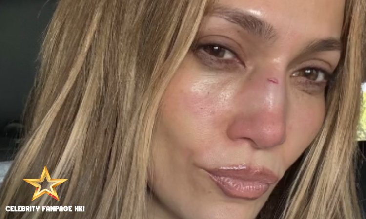 Jennifer Lopez compartilha lesão no rosto que sofreu durante ensaio para o AMAs